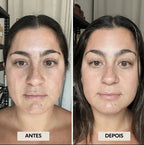 GlowFace - Escova de Drenagem Linfática Facial