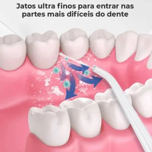 Irrigador Oral Portátil 3 em 1 — OralGlow Pro