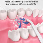 Irrigador Oral Portátil 3 em 1 — OralGlow Pro