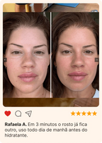 Massageador Facial de Gelo - GlowFrost