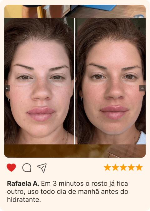 Massageador Facial de Gelo - GlowFrost