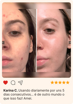 Massageador Facial de Gelo - GlowFrost