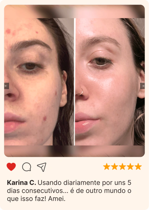 Massageador Facial de Gelo - GlowFrost